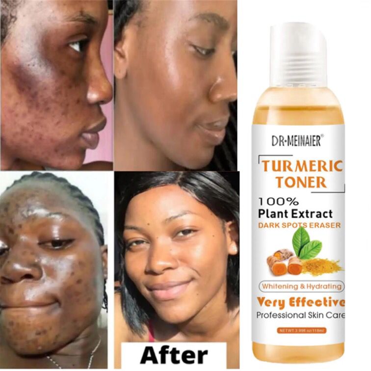 DR-MEINAIER Collagen Toner